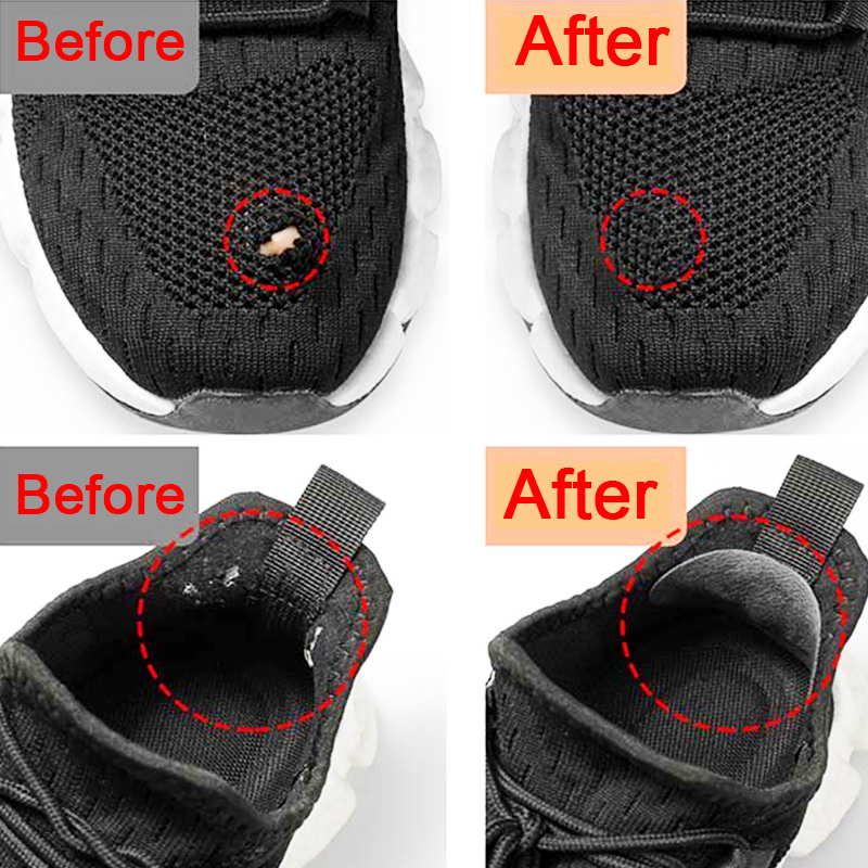 Sports Shoes Patches Vamp Repa - Sneaker Care Kit ulasan dan harga